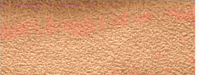 K296-11